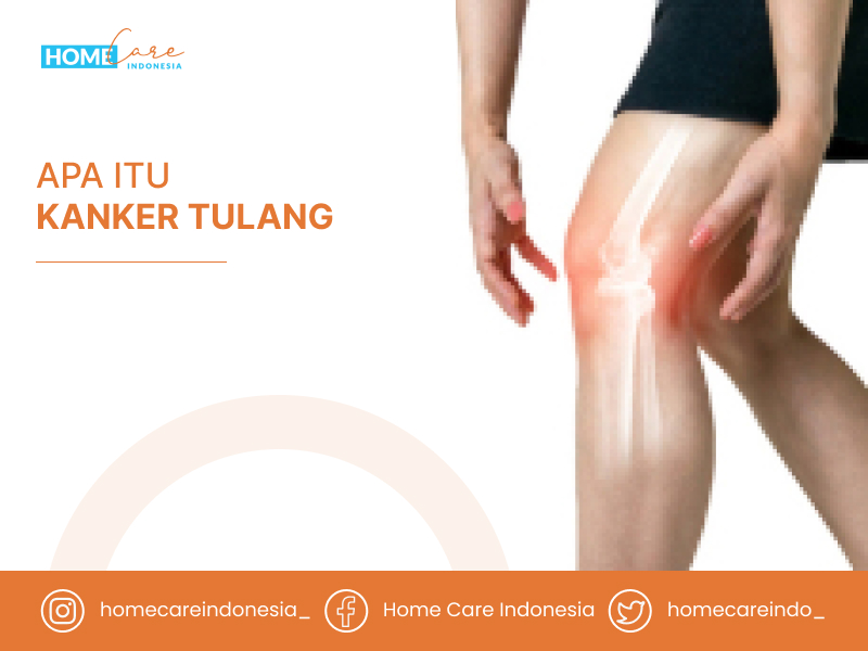 Apa Itu Kanker Tulang – Homecare Indonesia